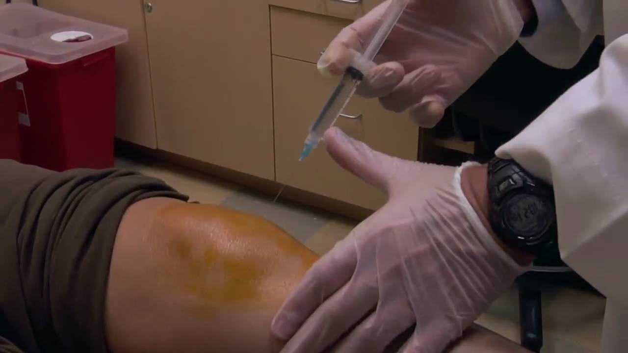 Prolotherapy Performed On The Knee: Dr. Marc Darrow