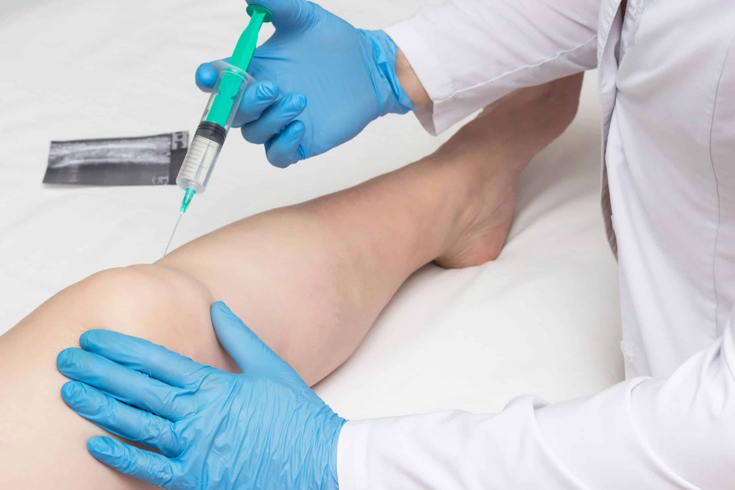 botox knee injections