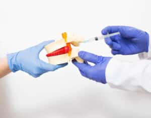 Patients with spinal stenosis seek information on alternatives on epidurals and other injections1