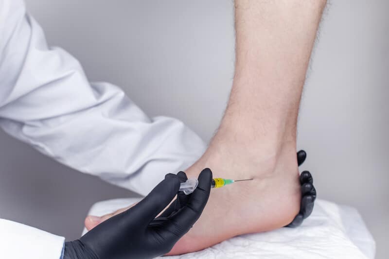 cortisone Peroneal tendon cortisone Peroneal tendon
