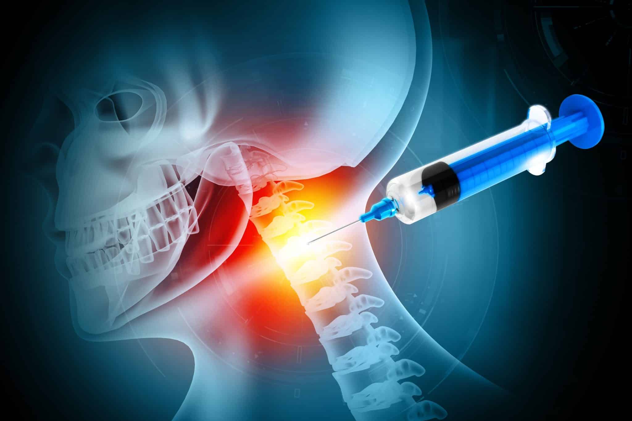 cervical neck injections scaled