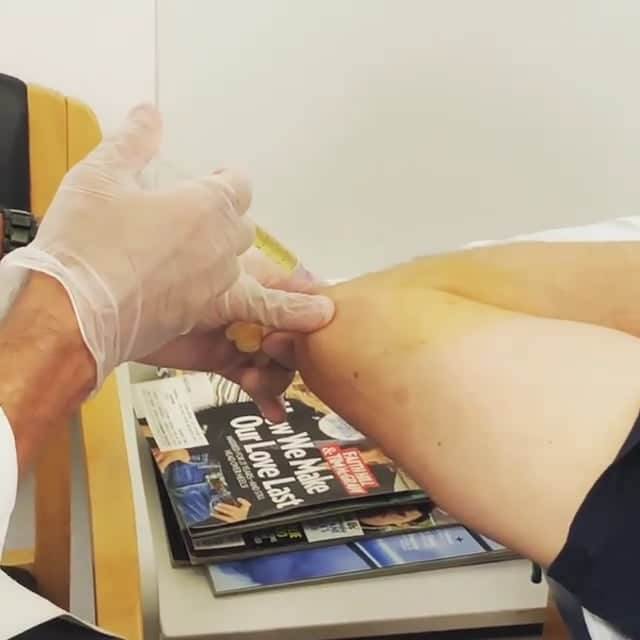 PRP Elbow Injections