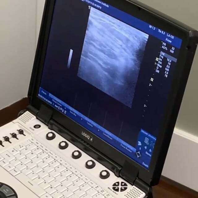 Ultrasound guidance knee injections