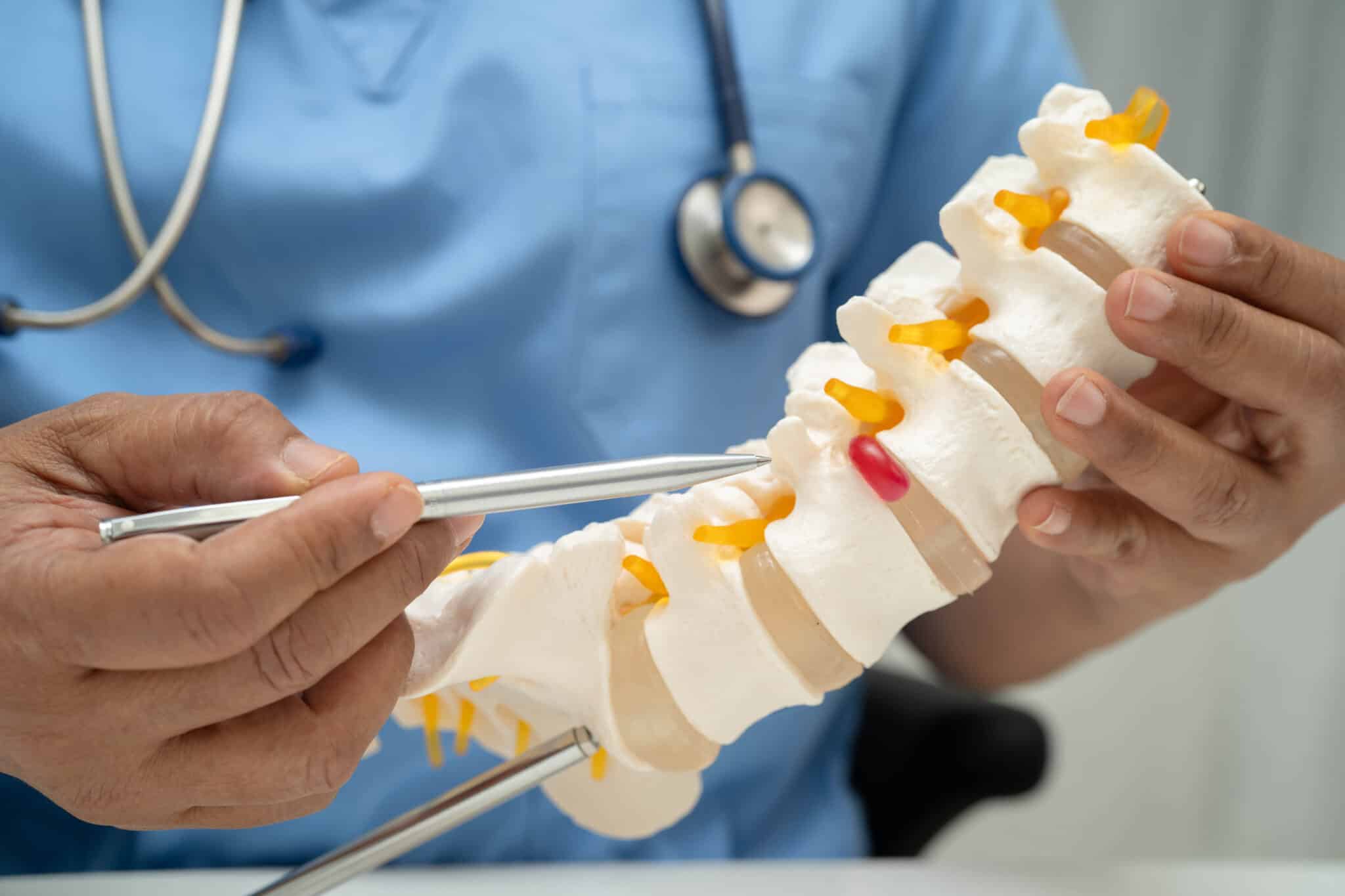 Doctor holding a 3D model of the sciatic nerve