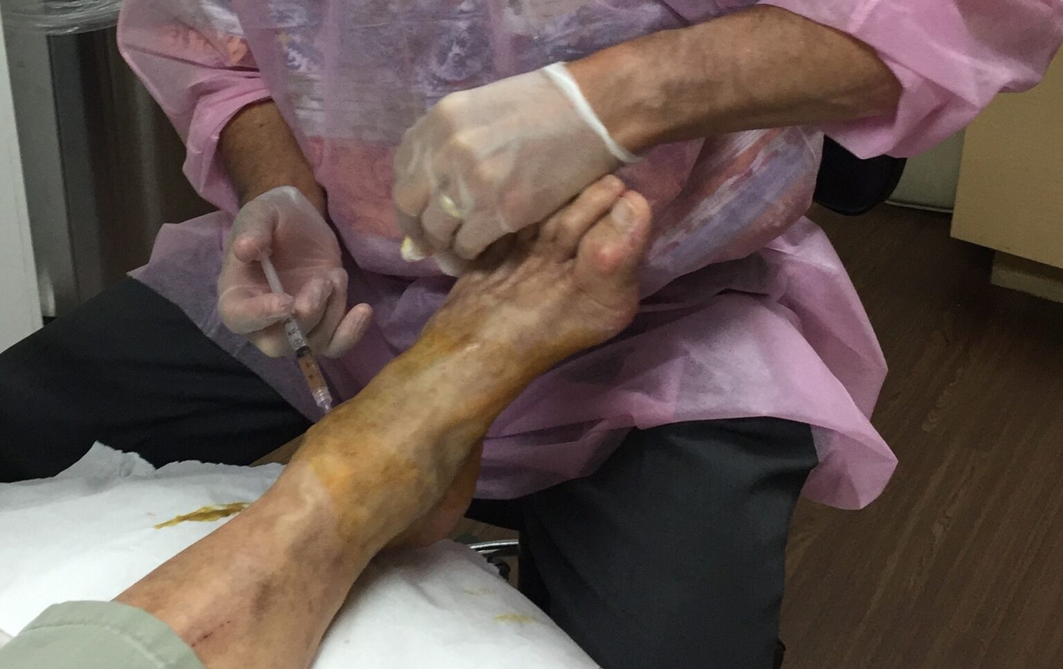 Darrow ankle 1 e1696609754371