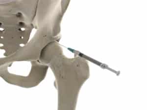 Hip injections1