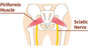 Illustration of piriformis and sciatic nerve